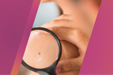 Prévention des cancers cutanés